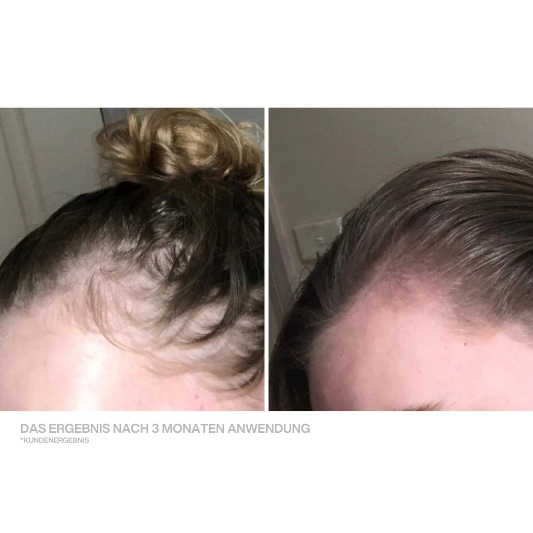 Scalp Therapy Brush - The Original